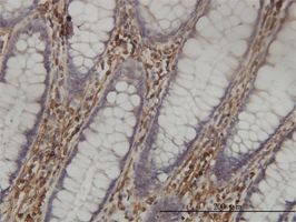 SHMT1 antibody (ab55736) used in immunohistochemistry at 5ug/ml on formalin fixed and paraffin embedded human colon tissue.
