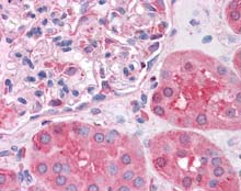 ab115665, at 5µg/ml, staining SHMT1 in Formalin-fixed, Paraffin-embedded Human Kidney tissue by Immunohistochemistry.
