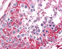 ab115665, at 5µg/ml, staining SHMT1 in Formalin-fixed, Paraffin-embedded Human Testis tissue by Immunohistochemistry.