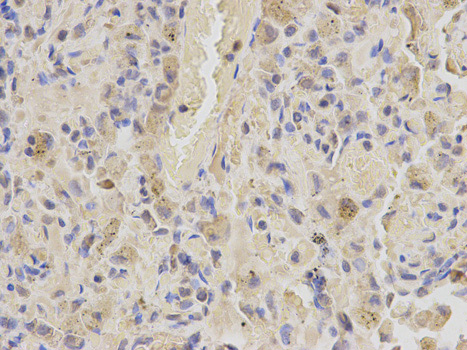 Immunohistochemistry (Formalin/PFA-fixed paraffin-embedded sections) analysis of human lung tissue labelling SHMT2 with ab180786 at 1/200. Magnification: 400x.