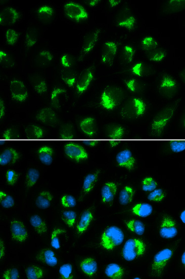 Immunocytochemistry/Immunofluorescence analysis of HepG2 cells using ab180786. Blue DAPI for nuclear staining.