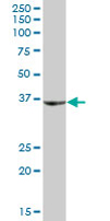 Anti-SHOX antibody (ab67927) at 1/500 dilution + human liver tissue lysate at 25 µgSecondaryGoat Anti-Mouse IgG (H&L)-HRP Conjugate at 1/2500 dilution