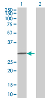 All lanes : Anti-SHOX antibody (ab67927) at 1/500 dilutionLane 1 : SHOX transfected 293T cell lysateLane 2 : Non-transfected 293T cell lysateLysates/proteins at 25 µg per lane.SecondaryGoat Anti-Mouse IgG (H&L)-HRP Conjugate at 1/2500 dilution