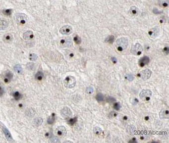 Image courtesy of Human Protein Atlasab21633 staining Shugoshin in Human hippocampus. Paraffin embedded human hippocampus tissue was incubated with ab21633 (1/350 dilution) for 30 mins at room temperature. Antigen retrieval was performed by heat induction in citrate buffer pH 6.ab21633 was tested in a tissue microarray (TMA) containing a wide range of normal and cancer tissues as well as a cell microarray consisting of a range of commonly used, well characterised human cell lines. Further results for this antibody can be found at www.proteinatlas.org