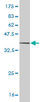 Western blot against tagged recombinant protein immunogen using ab55738 SI antibody at 1ug/ml.