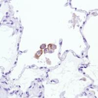 Immunohistochemical analysis of formalin fixed, paraffin embedded Human lung tissue sections labeling Sialoadhesin using ab183356 at a 1/100 dilution.