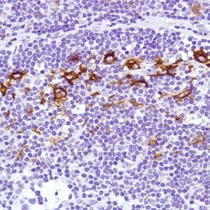 Immunohistochemical analysis of formalin fixed, paraffin embedded Human lymph node tissue sections labeling Sialoadhesin using ab183356 at a 1/100 dilution.