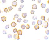 ab25875 at 10µg/ml in A549 staining SIGIRR in A549 cells by ICC/IF