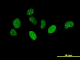 ab69447 at 10µg/ml staining NUP43 in Hela cells by ICC/IF.