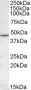 Anti-Nicotinic Acetylcholine Receptor beta 2 antibody (ab85693) at 1 µg/ml + Human cerebellum lysate (in RIPA buffer) at 35 µgdeveloped using the ECL technique