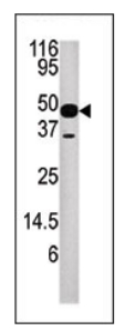 Anti-NUP54 antibody (ab71315) at 1/100 dilution + mouse heart tissue lysate at 12.5 µg