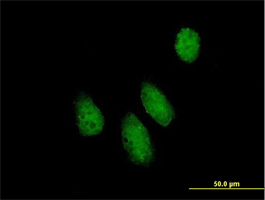 ab69954 at 10µg/ml staining NUPL1 in Hela cells by Immunocytochemistry/Immunofluorescence.