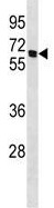 Anti-Nicotinic Acetylcholine Receptor beta 4 antibody - C-terminal (ab156213) at 1/100 dilution + 293 cell lysate at 35 µg
