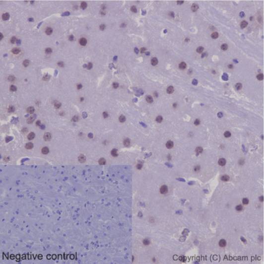 Immunohistochemical analysis of paraffin-embedded mouse brain tissue labeling NXN with ab191429 at 1/100 with prediluted HRP Polymer for Rabbit IgG as secondary antibody. Negative control: Using PBS instead of primary antibody.