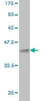 Western blot against tagged recombinant protein immunogen using ab54624 Nicotinic Acetylcholine Receptor epsilon antibody at 1ug/ml.