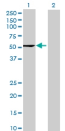 All lanes : Anti-NXN antibody (ab69063) at 1/500 dilutionLane 1 : NXN transfected 293T cell lysateLane 2 : Non-transfected 293T cell lysateLysates/proteins at 25 µg per lane.SecondaryGoat anti-mouse IgG (H&L)-HRP conjugate at 1/2500 dilution