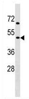 Anti-Nicotinic Acetylcholine Receptor gamma antibody (ab130560) at 1/100 dilution + CEM cell lysate at 35 µg