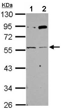 All lanes : Anti-Nicotinic Acetylcholine Receptor gamma antibody (ab151627) at 1/1000 dilutionLane 1 : 293T whole cell lysateLane 2 : A431 whole cell lysateLysates/proteins at 30 µg per lane.