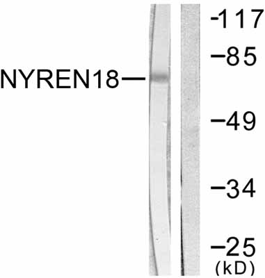 All lanes : Anti-NYREN18 antibody (ab58401) at 1/500 dilutionLane 1 : COS7 cell extractLane 2 : COS7 cell extract with immunizing peptide