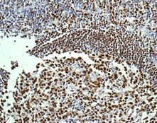 Immunohistochemical analysis of paraffin-embedded Human tonsil tissue labeling Oct-2 with ab178679 at 1:100 dilution.
