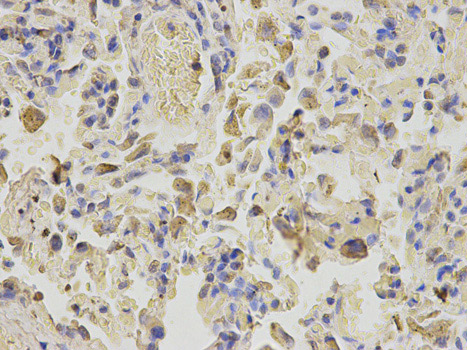 Immunohistochemistry (Formalin/PFA-fixed paraffin-embedded sections) analysis of human lung tissue labelling Niemann Pick C2 with ab186829 at 1/200. Magnification: 400x.