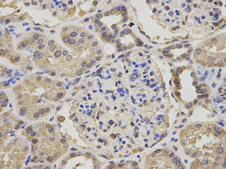 Immunohistochemistry (Formalin/PFA-fixed paraffin-embedded sections) analysis of human kidney tissue labelling Niemann Pick C2 with ab186829 at 1/200. Magnification: 400x.