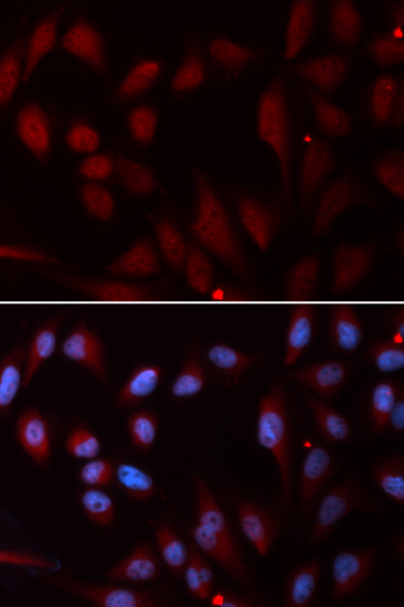 Immunocytochemistry/Immunofluorescence analysis of U2OS cells using ab186829. Blue DAPI for nuclear staining.