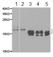 All lanes : Anti-Niemann Pick C2 antibody (ab186829) at 1/500 dilutionLane 1 : 293T cell extractLane 2 : M21 cell extractLane 3 : Mouse lung cell extractLane 4 : Mouse spleen cell extractLane 5 : Mouse liver cell extract