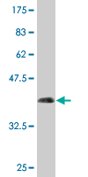 Anti-Niemann Pick C2 antibody (ab77453) at 5 µg/ml + immunogen at 0.2 µgSecondaryGoat Anti-Mouse IgG (H&L)-HRP Conjugate at 1/5000 dilution