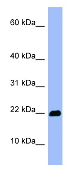 Anti-Olfactory Marker Protein antibody (ab98124) at 1 µg/ml (in 5% skim milk / PBS buffer) + HepG2 cell lysate at 10 µg