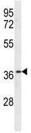 Anti-Olfactory receptor 10X1 antibody (ab106966) at 1/100 dilution + mouse cerebellum tissue lysates at 35 µg