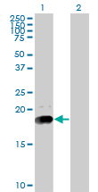 All lanes : Anti-Niemann Pick C2 antibody (ab77453) at 5 µg/mlLane 1 : Niemann Pick C2 transfected 293T cell lysateLane 2 : Non transfected 293T cell lysateLysates/proteins at 25 µg per lane.SecondaryGoat Anti-Mouse IgG (H&L)-HRP Conjugate at 1/2500 dilution