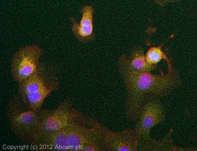 ICC/IF image of ab151529 stained DU145 cells. The cells were 100% methanol fixed (5 min) and then incubated in 1%BSA / 10% normal goat serum / 0.3M glycine in 0.1% PBS-Tween for 1h to permeabilise the cells and block non-specific protein-protein interactions. The cells were then incubated with the antibody (ab151529, 5µg/ml) overnight at +4°C. The secondary antibody (green) was ab96899, DyLight® 488 goat anti-rabbit IgG (H+L) used at a 1/250 dilution for 1h. Alexa Fluor® 594 WGA was used to label plasma membranes (red) at a 1/200 dilution for 1h. DAPI was used to stain the cell nuclei (blue) at a concentration of 1.43µM.