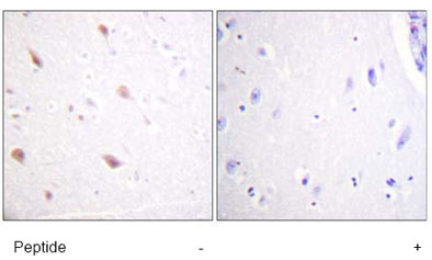 ab61110 at a 1/50-1/100 dilution, staining human NIFK in brain tissue with (+) or without (-) immunising phospopeptide, using Immunohistochemistry, Paraffin embedded tissue