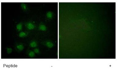 ab61110, at a 1/100-1/500 dilution, staining human NIFK in HuvEC cells with (+) or without (-) immunising phospopeptide, using Immunofluorescence