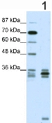 Anti-Olig2 antibody (ab42453) at 0.5 µg/ml (in 5% skim milk/PBS buffer) + Jurkat cell lysateSecondaryHRP conjugated anti-Rabbit IgG at 1/50000 dilution