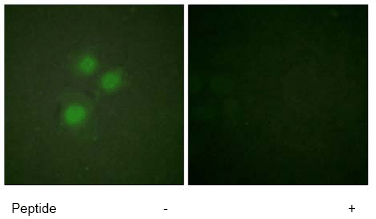 ab61203 at 1/100 dilution staining NIFK in HuvEc cells by Immunofluorescence, in the absence (left) or presence (right) of the immunising peptide.
