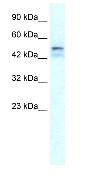 Anti-ONECUT2 antibody (ab28466) at 1.25 µg/ml + Jurkat cell lysate
