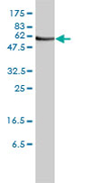 Anti-ORC2 antibody (ab68348) at 1/500 dilution + Jurkat cell lysate at 25 µg/mlSecondaryGoat Anti-Mouse IgG (H&L)-HRP Conjugate at 1/2500 dilution
