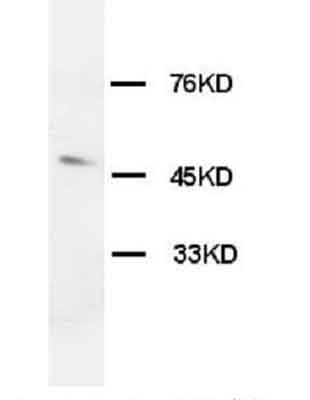 Anti-Orexin Receptor 1 antibody (ab68718) at 2 µg/ml + rat brain tissue lysate