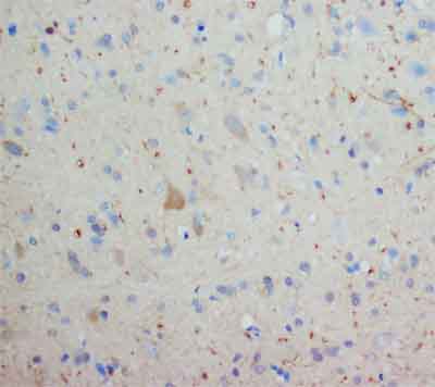 ab68718 staining Orexin Receptor 1 in rat brain tissue by Immunohistochemistry (formalin fixed, paraffin embedded tissue section). Primary antibody used at 2µg/ml.