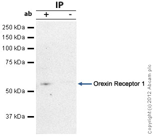 Orexin Receptor 1 was immunoprecipitated using 0.5mg Rat Brain tissue lysate, 5µg of Rabbit polyclonal to Orexin Receptor 1 and 50µl of protein G magnetic beads (+). No antibody was added to the control (-). The antibody was incubated under agitation with Protein G beads for 10min, Rat Brain tissue lysate lysate diluted in RIPA buffer was added to each sample and incubated for a further 10min under agitation.Proteins were eluted by addition of 40µl SDS loading buffer and incubated for 10min at 70oC; 10µl of each sample was separated on a SDS PAGE gel, transferred to a nitrocellulose membrane, blocked with 5% BSA and probed with ab68718.Secondary: Mouse monoclonal [SB62a] Secondary Antibody to Rabbit IgG light chain (HRP) (ab99697).Band: 52kDa; Orexin Receptor 1
