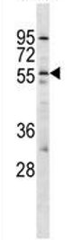 Anti-Orexin Receptor 2 antibody (ab129432) at 1/100 dilution + Jurkat cell lysate at 35 µg