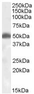 Anti-Orexin Receptor 2 antibody (ab65093) at 1 µg/ml + Human Brain (Hippocampus) lysate (35µg protein in RIPA buffer).