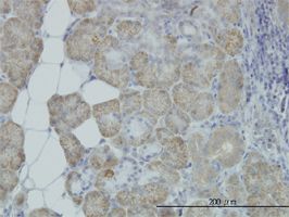 ORP150 antibody (ab56680) used in immunohistochemistry at 1ug/ml on formalin fixed and paraffin embedded human salivary gland.