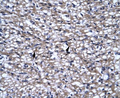 IHC staining of paraffin embedded human heart with ab28673 at 4.0-8.0 ug/ml. Positive staining (arrows) is myocardial cells. Magnification: x400