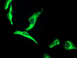 Immunofluorescent staining of OSGEP in HeLa cells using ab119067 at 1/100 dilution.
