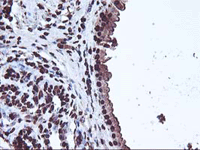 ab119311 at 1/150 dilution staining OSGEP in Paraffin-embedded Human Breast tissue by Immunohistochemistry.
