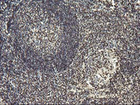 ab119311 at 1/150 dilution staining OSGEP in Paraffin-embedded Human tonsil tissue by Immunohistochemistry.