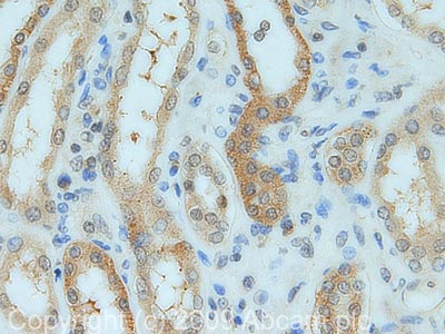 IHC image of Osteoprotegerin staining in Human Normal Kidney FFPE section, performed on a BondTM system using the standard protocol F. The section was pre-treated using heat mediated antigen retrieval with sodium citrate buffer (pH6, epitope retrieval solution 1) for 20 mins. The section was then incubated with ab73400, 5µg/ml, for 15 mins at room temperature and detected using an HRP conjugated compact polymer system. DAB was used as the chromogen. The section was then counterstained with haematoxylin and mounted with DPX.